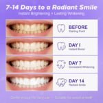 Smilekit Purple Whitening Strips – অ্যাডভান্সড টিথ হোয়াইটেনিং ফর্মুলা - Image 2